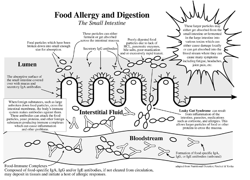 How foods penetrate the leaky gut causing allergic reactions