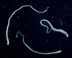 Three adult Hymenolepis nana tapeworms. Each t...