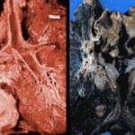 A close up of healthy versus smoker's lungs